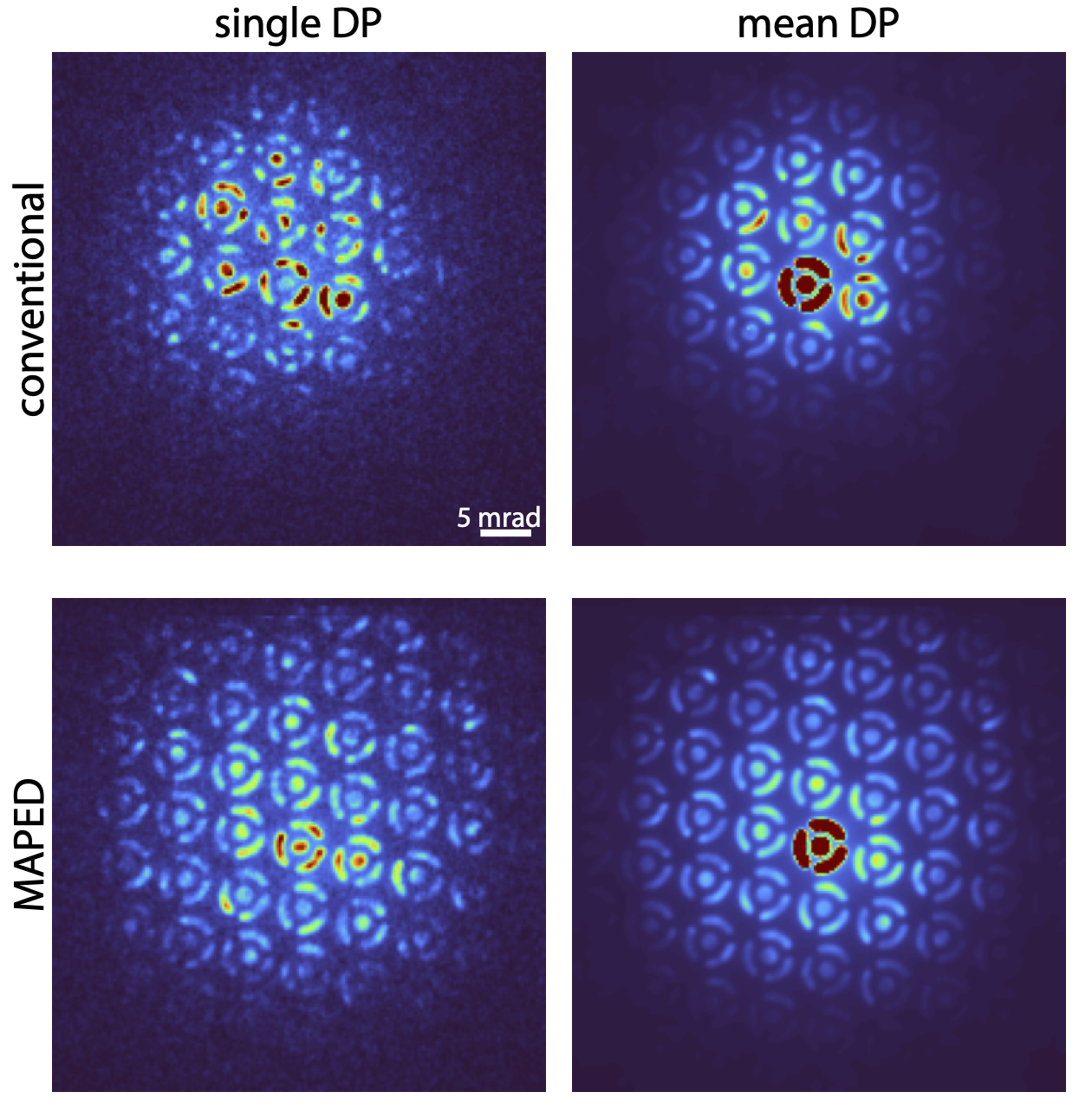 Multi-angle precession electron diffraction patterns combined into a MAPED diffraction map